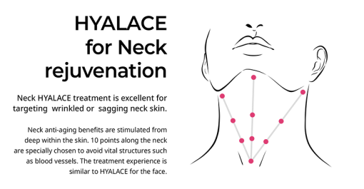 Hyalace Skin Booster